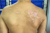 Bắt tạm giam người bố bạo hành con trai hơn 7 tuổi ở Phú Thọ
