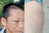 Xôn xao clip bé trai mắt bầm tím, khóc kêu cứu vì nhiều lần bị đánh đập khi ở cùng bố và vợ mới