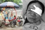 Liên tiếp xảy ra vụ xịt vòi nước cao áp vào người khác, luật sư nói gì?