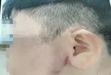 Điều tra vụ bé trai 9 tuổi nghi bị cha ruột bạo hành ở TPHCM