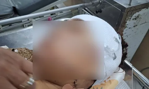 Đồng Tháp: Nữ cán bộ phường khai lý do rạch mặt người phụ nữ nhậu với chồng