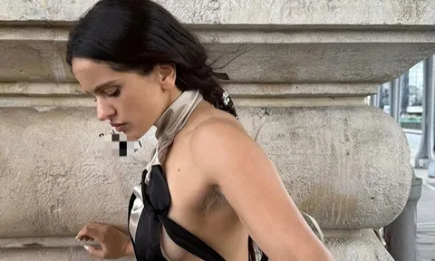 Nữ ca sĩ nhuộm lông nách trắng: Chất chơi hay chiêu gây chú ý?