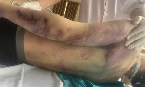 Tạm đình chỉ hoạt động Trung tâm Công tác xã hội Hải Hà để điều tra vụ học viên bị đánh tử vong