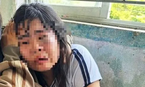 Nữ sinh lớp 7 bị 2 nam sinh lớp 9 đánh nhập viện