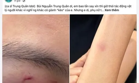 Công an xác minh thông tin ca sĩ Trung Quân Idol bị tố hành hung nữ bác sĩ