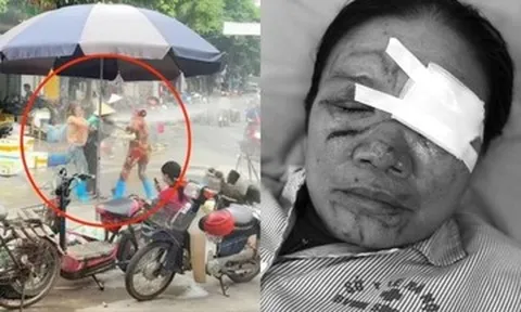 Liên tiếp xảy ra vụ xịt vòi nước cao áp vào người khác, luật sư nói gì?