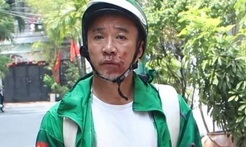 Khởi tố kẻ cướp giật nguy hiểm, kéo lê nạn nhân trên đường ở TPHCM