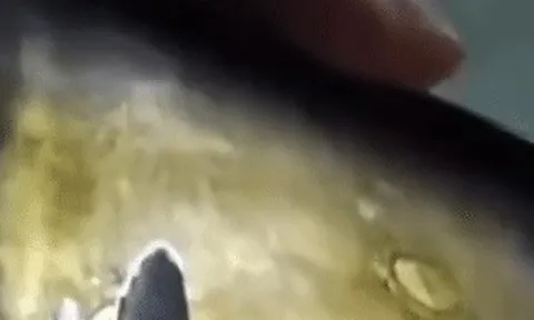 Truy tìm con chó 20kg lao vào tấn công bé trai 6 tuổi ở Đồng Nai