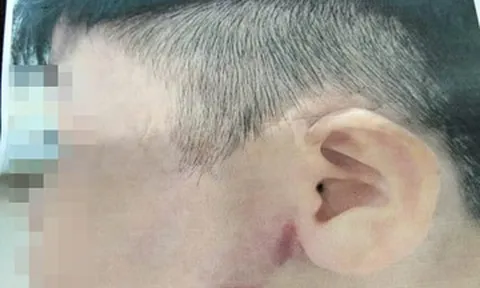 Điều tra vụ bé trai 9 tuổi nghi bị cha ruột bạo hành ở TPHCM