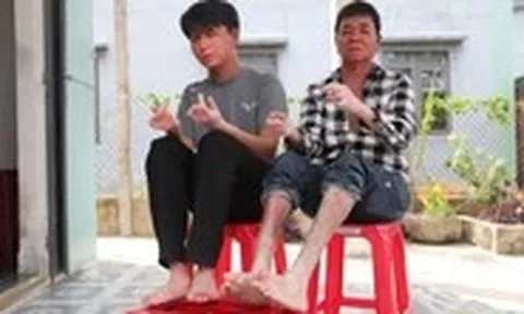 24 tuổi đời tràn ngập đau đớn, nam sinh 'người rắn' dũng cảm bước vào đại học
