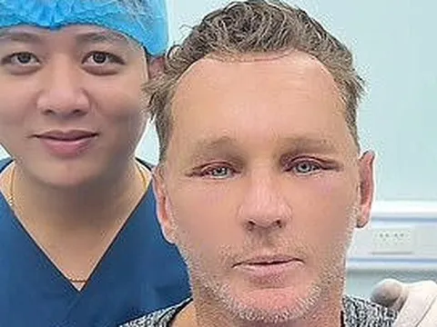 Khách Tây đổi đời sau khi tới Việt Nam phẫu thuật thẩm mỹ