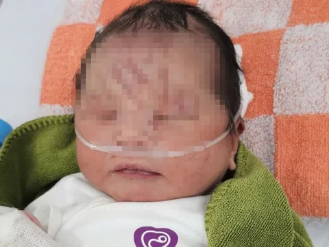 Bé sơ sinh bị vùi lấp ở Gia Lai chính thức được nhận nuôi